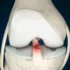 ligamenti kolena